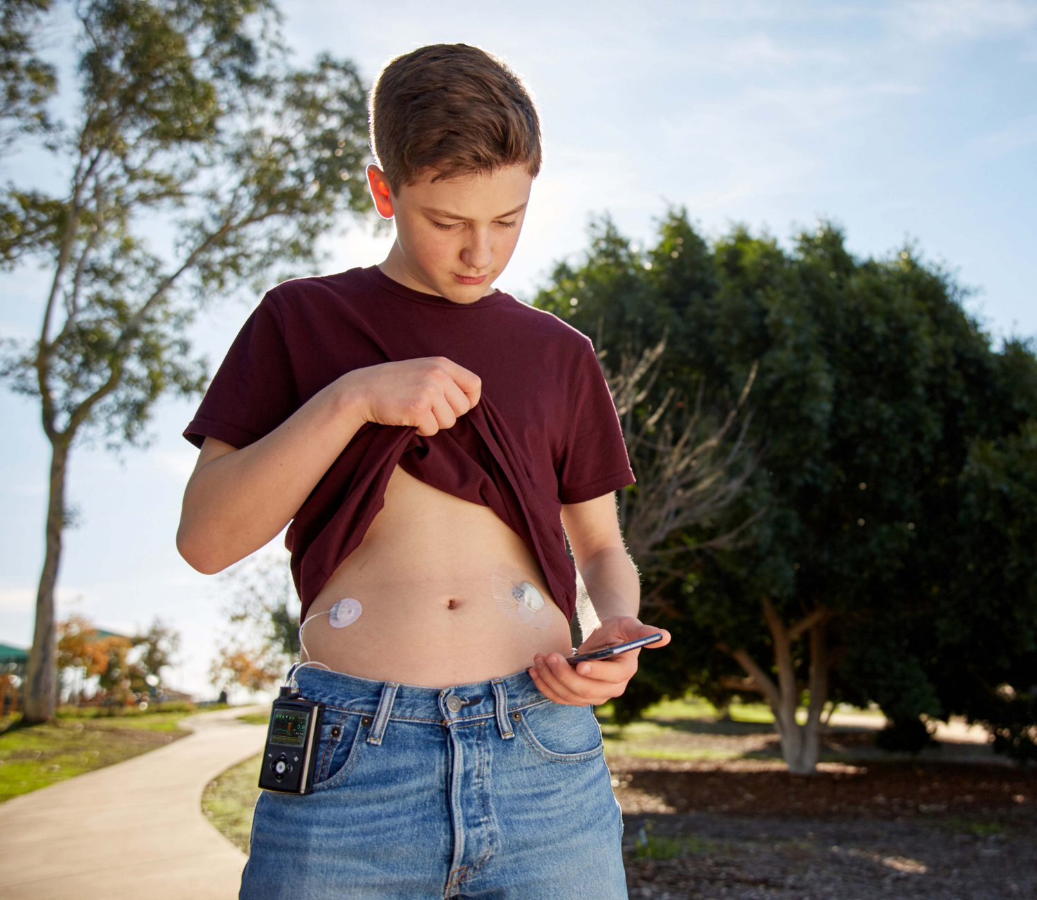 5 Signs You Might Need to Switch to an Insulin Pump