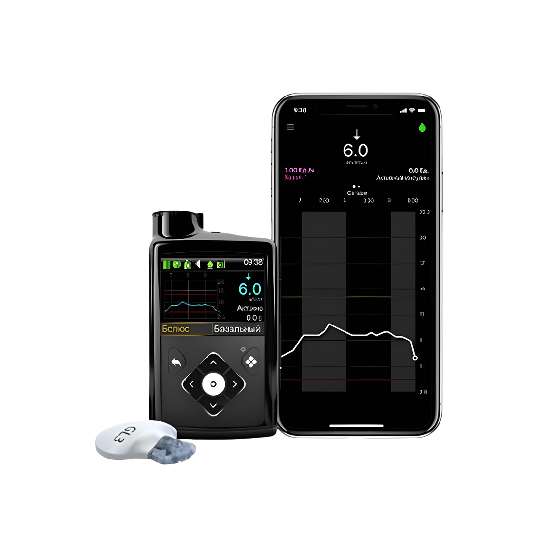 MiniMed 720G Insulin Pump