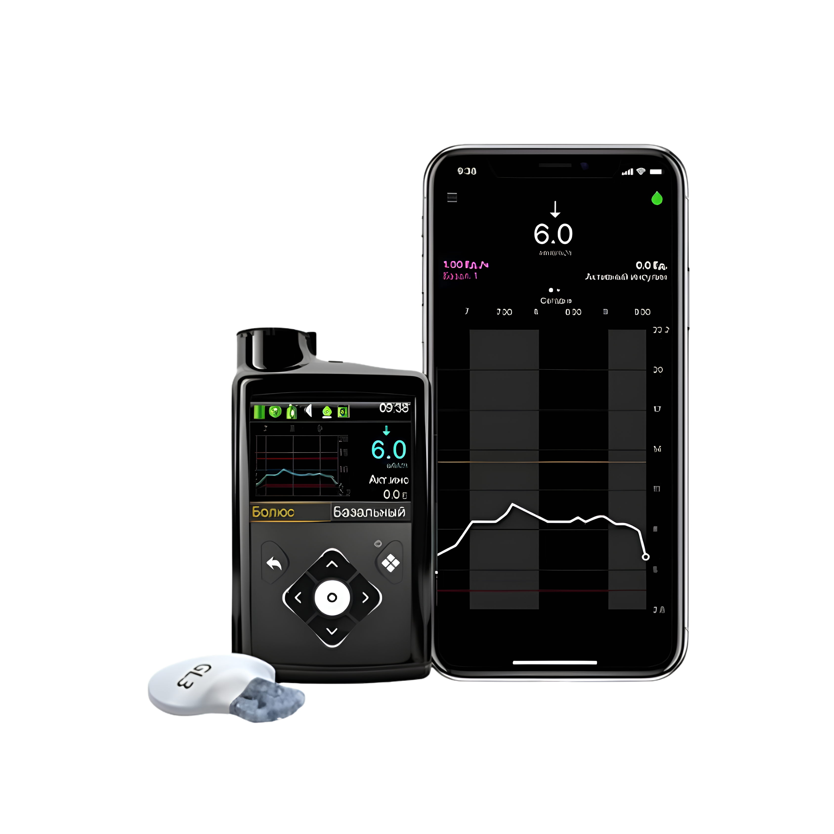 MiniMed 720G Insulin Pump