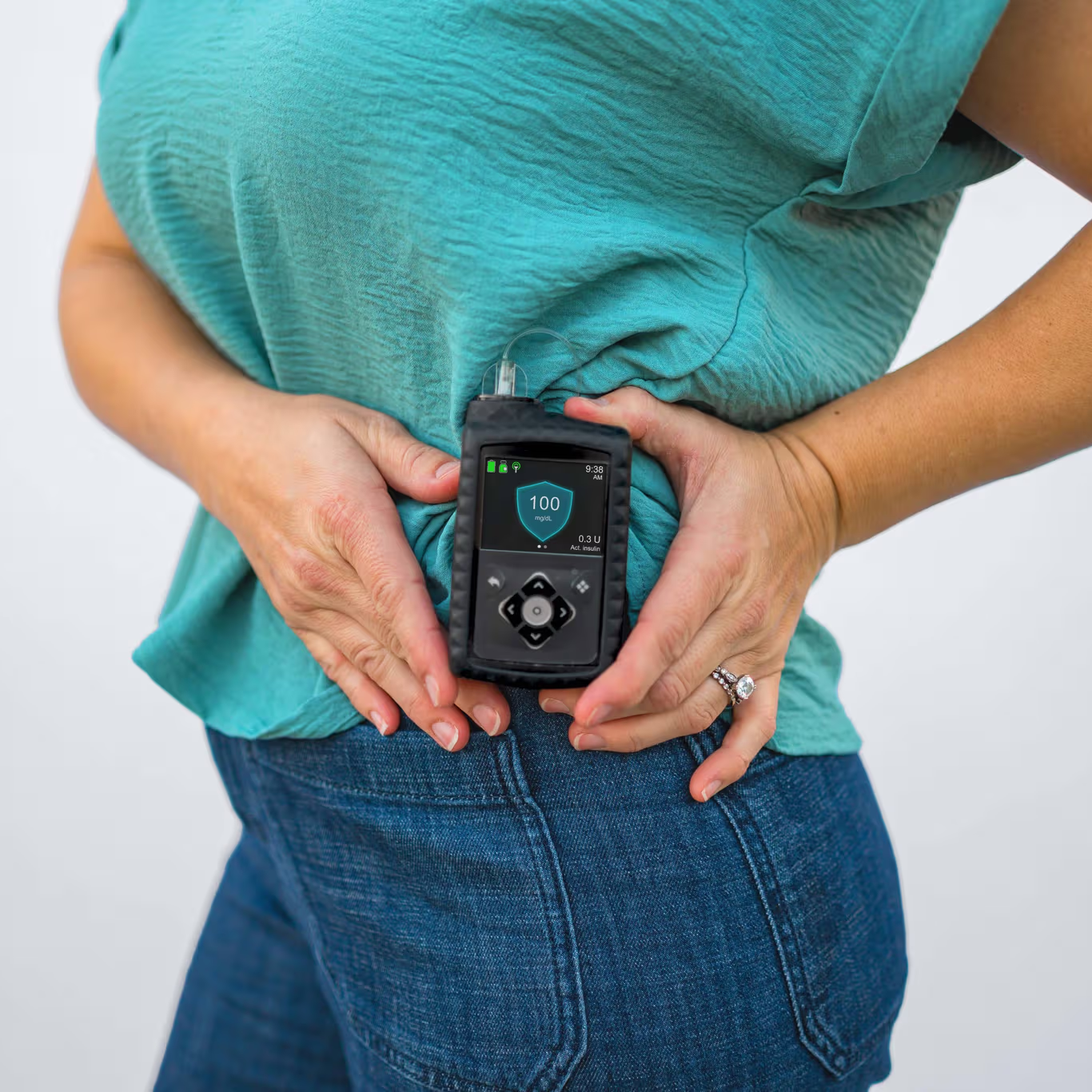 MiniMed 780G Insulin Pump