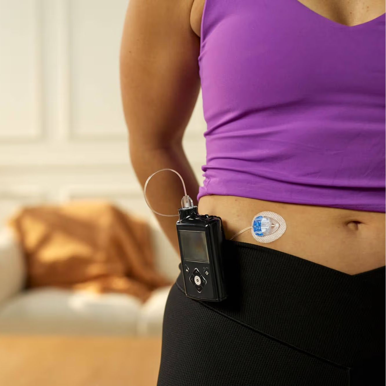 MiniMed 780G Insulin Pump